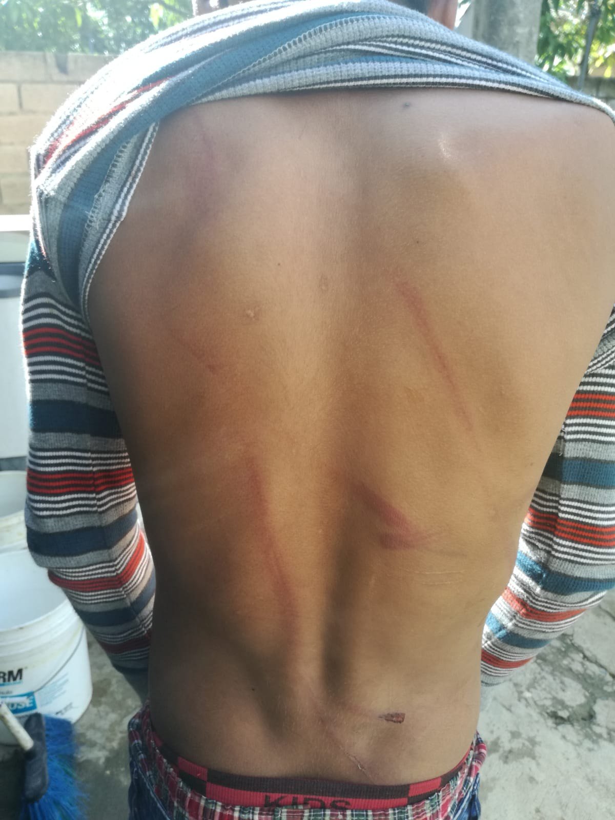 Denuncian maltrato físico infantil en El Valiente