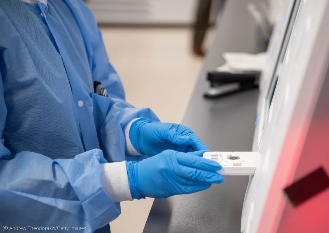 Expertos estiman pandemia de coronavirus daña batalla contra SIDA