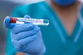 Salud Pública reporta 156 casos nuevos de coronavirus y una defunción en las últimas 24 horas