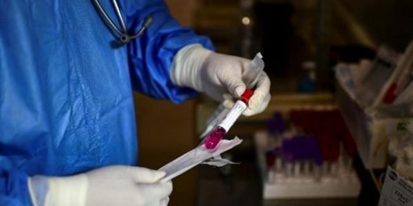 Salud Pública reporta tres defunciones por Covid 19 y aclara que solo una corresponde a las últimas 24 horas