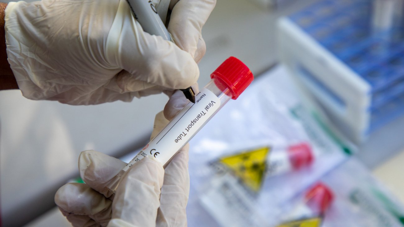 Casos Covid 19 siguen en aumento: Salud Pública reportó 2 muertes y 2.026 nuevos contagios