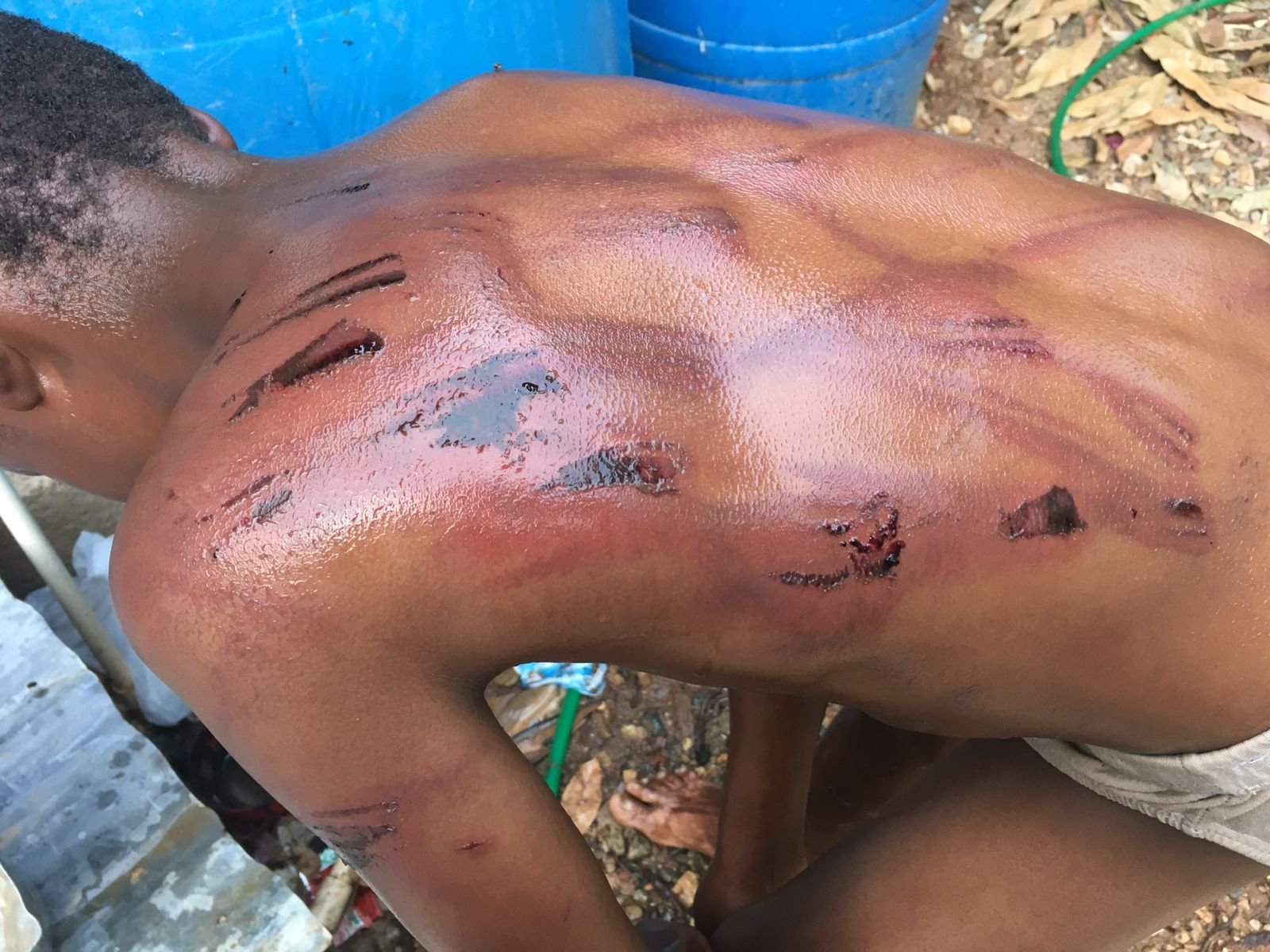 PN busca padre golpeó severamente hijo menor en Montecristi