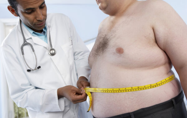 La obesidad: Una enfermedad que afecta a gran parte de la población mundial