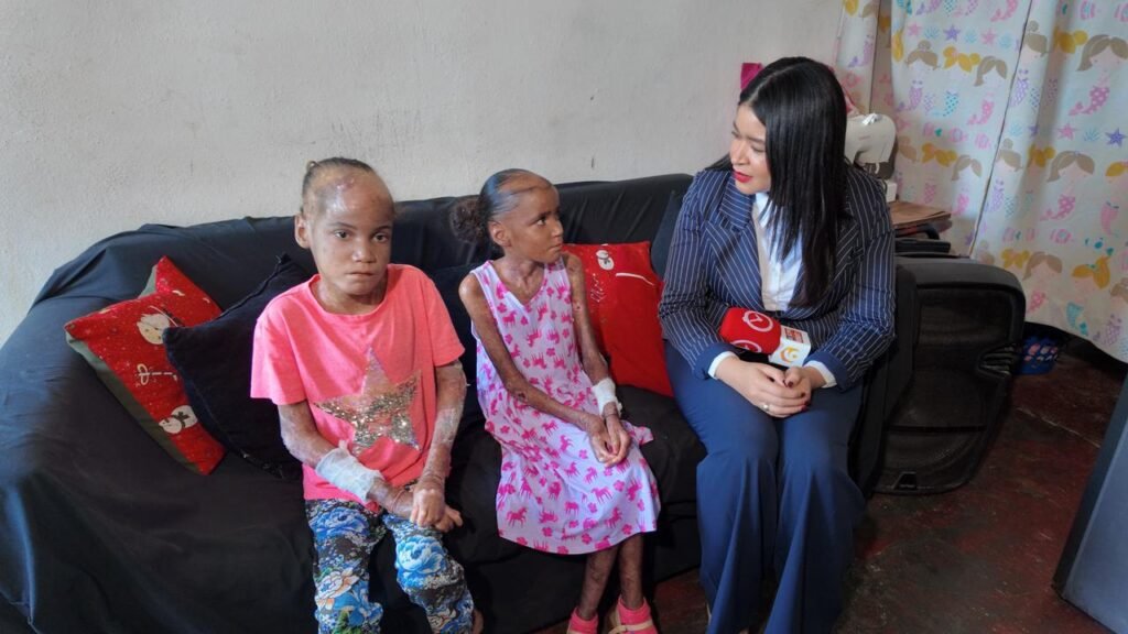 Dos hermanitas con “piel de mariposa” sobreviven en condiciones precarias y piden ayuda en SDE - Noticias de hoy en República Dominicana | De Último Minuto